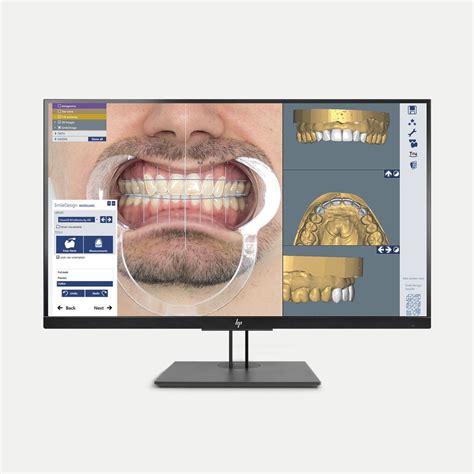 Módulo De Software Para Laboratório De Prótese Dentária Ceramill® M