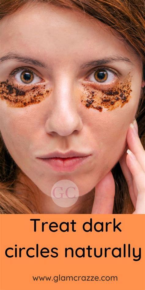 How To Get Rid Of Dark Circles At Home Overnight Trabeauli Artofit