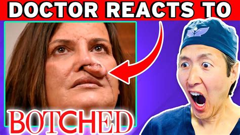 Plastic Surgeon Reacts To BOTCHED WTF Happened To Her NOSE YouTube