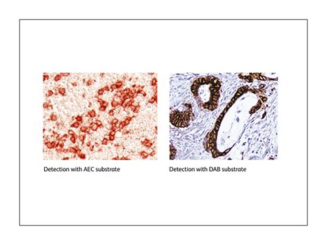 Immunohistochemistry Antibody Staining Ihc Detection