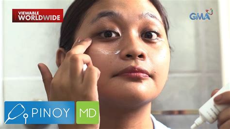 Maitim At Malalim Na Eyebags Paano Nga Ba Maaalis Pinoy MD Video