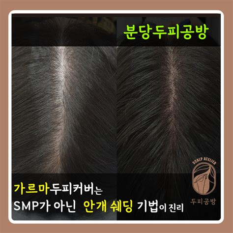 여자가르마두피문신 Smp가 아닌 파우더쉐딩기법으로 가르마커버