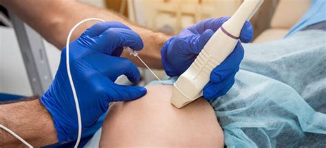 Radiofrequency Nerve Ablation Innovative Pain Care Center