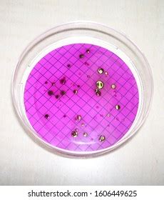 Fecal Coliform Bacteria Photos, Images & Pictures | Shutterstock