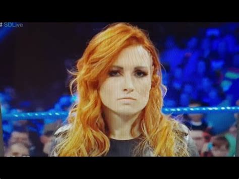 Backstage Update On Becky Lynch Injury And Contract Status With Wwe