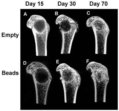 Representative 2D Pictures Of The Median Region Of Micro CT 3D