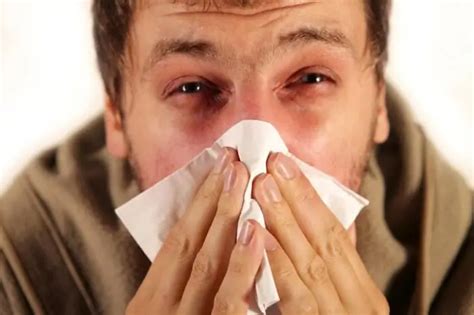 Allergic Rhinitis Symptoms And Treatment Causes Allergies