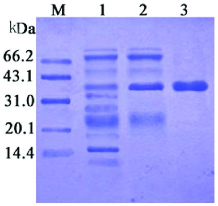 Sds Page Analysis Of The Purified Recombinant Cen M Marker