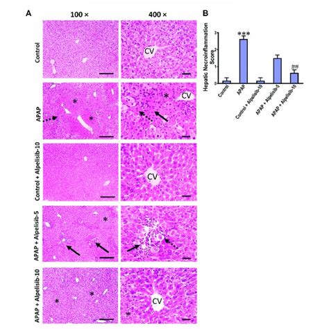 Impact Of Pretreatment With Alpelisib And Mg Kg On Apap Induced