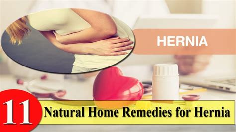 11 Natural Home Remedies For Hernia Youtube