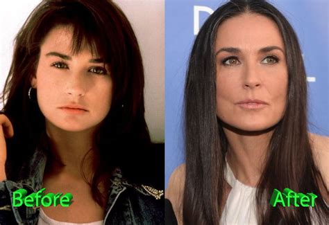 Demi Moore Plastic Surgery Gone Too Far