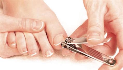 Solutions Pour Soigner Un Ongle Incarn De Fa On Naturelle