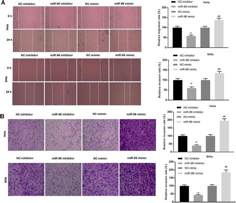 Microrna 96 5p Promoted Migration And Invasion Of Cervical Cancer Cc Download Scientific