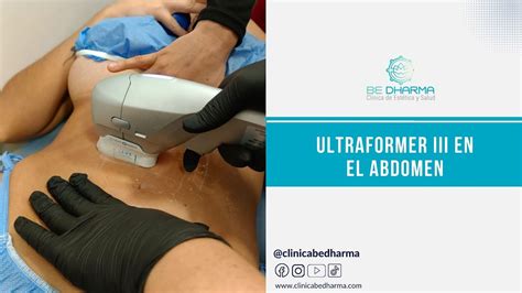 Para qué sirve Ultraformer III en el abdomen Clínica Estética en