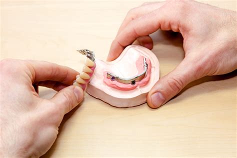 Totalprothesen - MT-DENTAL Zahntechnik GmbH