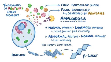 Video Amyloidosis