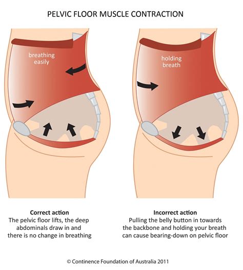 Women · Working your pelvic floor · Pelvic Floor First | Pelvic floor dysfunction, Pelvic floor ...