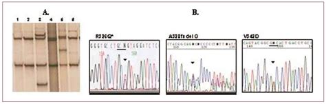 Mutations In Sarcomeric Genes Myh Mybpc Tnnt Tnni And Tpm In