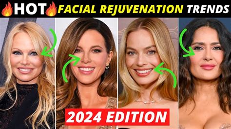 World Class Plastic Surgeon Predicts The Hottest Facial Rejuvenation