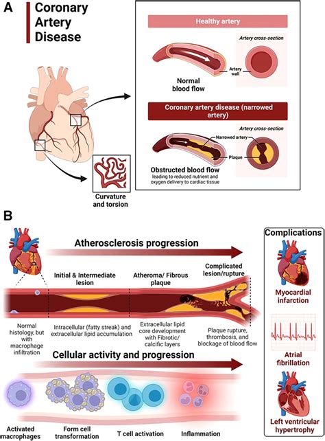 frontiers hypertensive heart disease risk factors complications