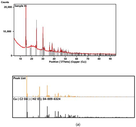 Chemical Studies of Multicomponent Kidney Stones Using the Modern