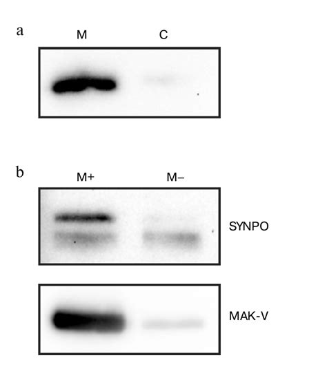 Interaction Of Synaptopodin With MAKKV Protein Kinase A Western Blot