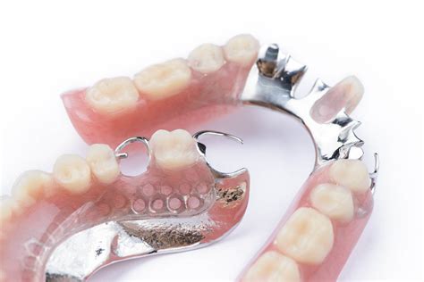 Prótesis Fija Y Removible Custom Dental En Barcelona