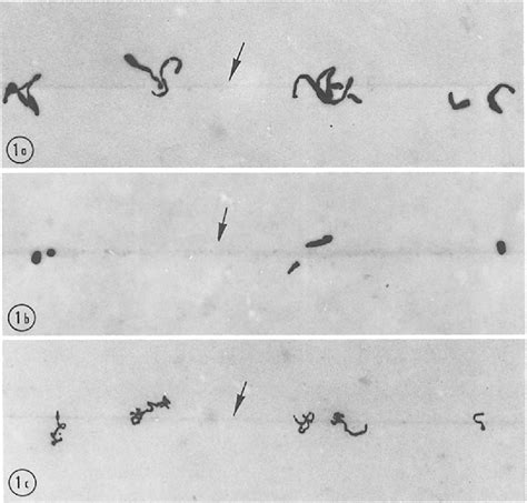 Figure From Resolution In Electron Microscope Autoradiography Iii