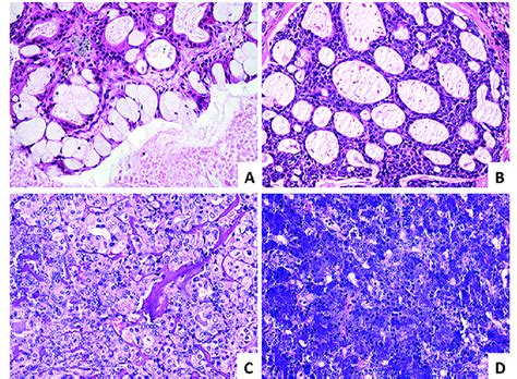 Representative Photomicrographs Of The Most Common Sgc A Download Scientific Diagram