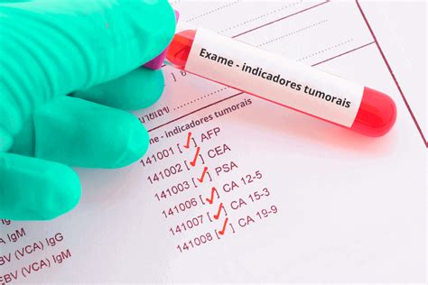 Qual exame de sangue detecta câncer e como confirmar o diagnóstico