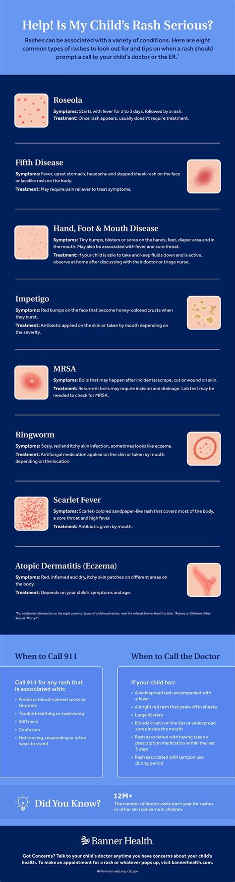 Common Childhood Rashes Chart