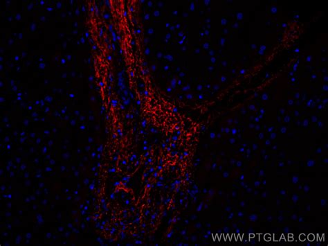 Serum Amyloid P Component Antibody Cl Proteintech