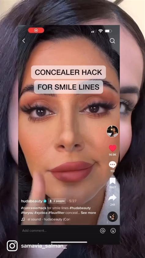 Smile Lines Hack