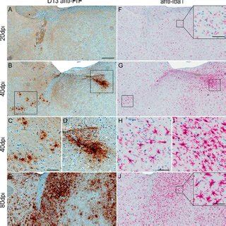 Early Detection Of Prpres In Scrapie Infected Brains A Immunoblot