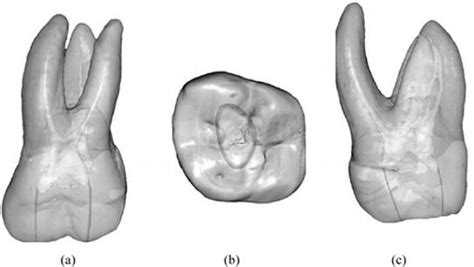 Maxillary First Molar Anatomy - Anatomical Charts & Posters