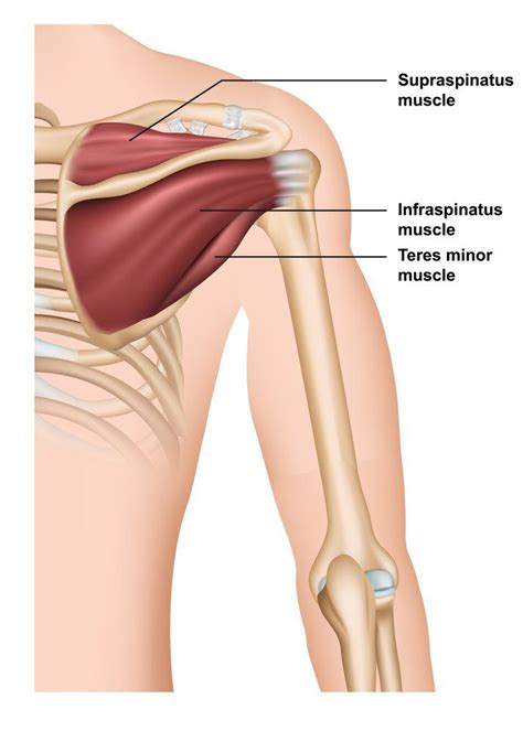 Supraspinatus Trigger Points A Guide To Understanding And Treating