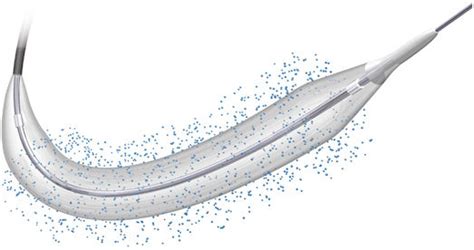 Cathéter PTCA BIOSTREAM Biosensors International coronaire à