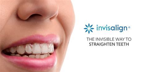 Invisalign Clear Braces Metro Dental Melbourne — Dentist Melbourne