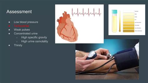 Fluids And Electrolytes Archer Nclex Content Review Webinar Ppt