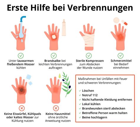 Das Richtige tun bei Verbrennungen Erste Hilfe schnell erklärt