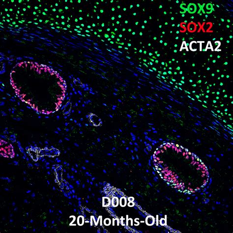 20 Month Old Human Lung Confocal Imaging SOX9 SOX2 And ACTA2