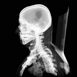 Understanding The Maths Of Computed Tomography CT Scans R Bloggers