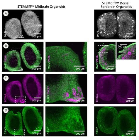 Stemdiff Midbrain Organoid Differentiation Kit Stemcell Technologies