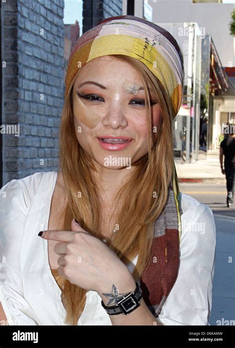 Tila Tequila Seen Shopping In Beverly Hills Sporting The Injuries She Received After Being