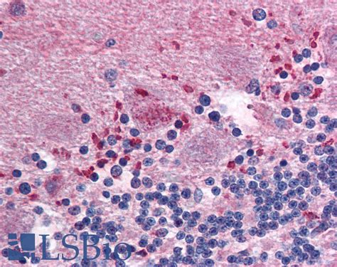 Ihc Plus™ Cldn12 Claudin 12 Polyclonal Antibody Rabbit Lsbio