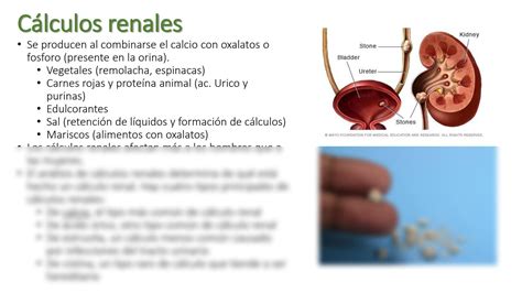 Solution Sistema Urinario Formaci N De Orina Studypool