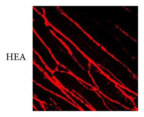 Confocal images of ICC-IM in each group showing the apoptosis of ...