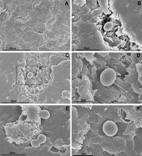 Low Temperature Scanning Electron Microscopy Images Of C Parvum