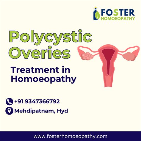 Homoeopathy Treatment For Pcod In Mehdipatnam Hyderabad