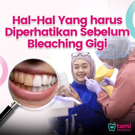 Hal Hal Yang Harus Diperhatikan Sebelum Melakukan Bleaching Gigi Tami